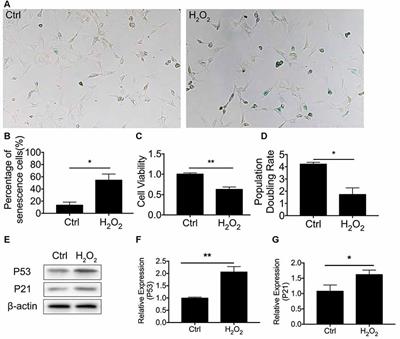 Inhibition of DRP-1-Dependent Mitophagy Promotes Cochlea Hair Cell Senescence and Exacerbates Age-Related Hearing Loss